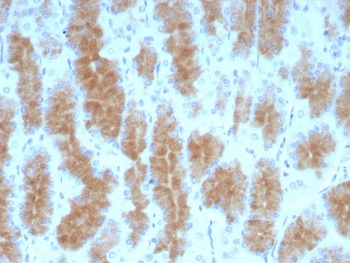 CEACAM1 Antibody / BGP-1
