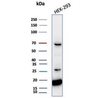 NME2 Antibody / Nucleoside diphosphate kinase B / NDKB