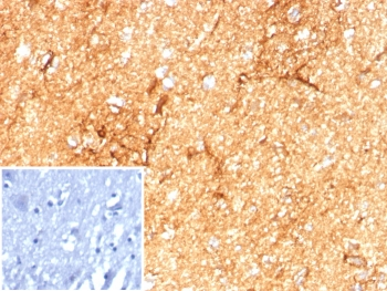 GFAP Antibody / Glial Fibrillary Acidic Protein