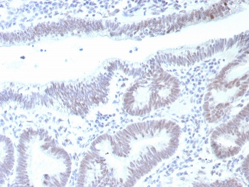 p53 Antibody / TP53