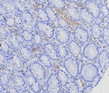 BCMA Antibody / CD269 / TNFRSF17
