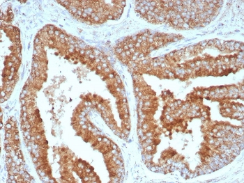 BCMA Antibody / CD269 / TNFRSF17