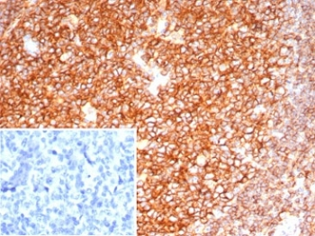 CD19 Antibody / B-lymphocyte marker