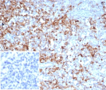 Alpha 1 Antitrypsin Antibody / AAT / SERPINA1