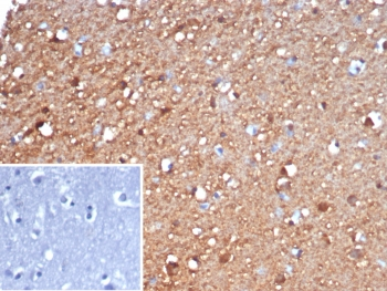 NSE Antibody / Neuron Specific Enolase
