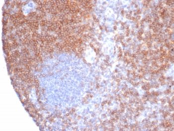 CD6 Antibody