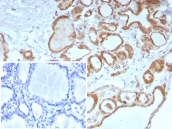 Calcitonin Antibody / CALCA / CGRP