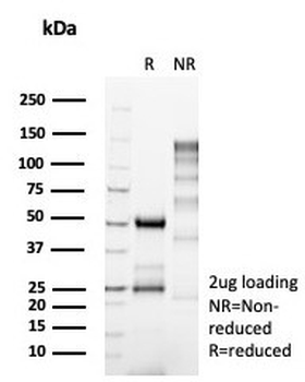 Neurogenin 3 Antibody / NGN3