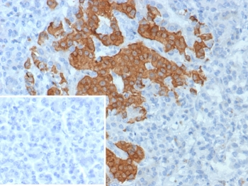 GAD65 Antibody / GAD2