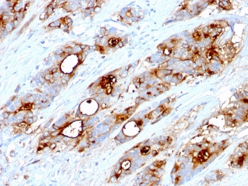 CEA Antibody / Carcinoembryonic Antigen