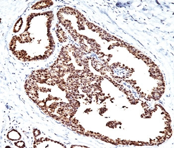 HSP60 Antibody
