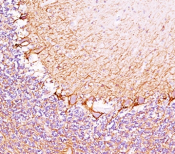 Neurofilament Antibody (-Heavy) / NF-H / NEFH