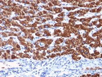 Hepatocyte Specific Antigen Antibody