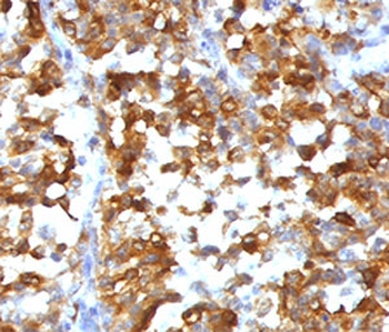 MART-1 / Melan-A Antibody