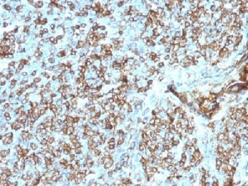 HLA-DP + HLA-DQ + HLA-DR Antibody (MHC II)