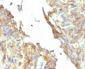 Tissue-nonspecific Alkaline Phosphatase Antibody / ALPL