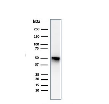 Thymidine Phosphorylase Antibody / PD-ECGF