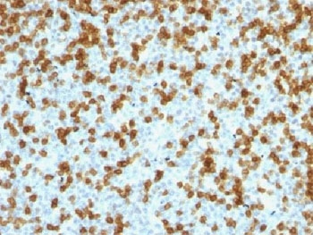 PDCD1 Antibody / PD-1 / PD1