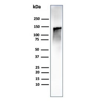 Caldesmon / CAD Antibody HMW