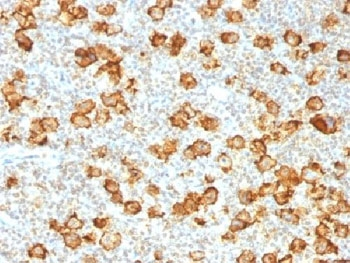 CD30 Antibody