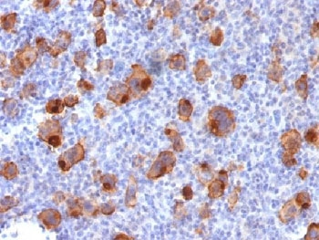 CD30 Antibody