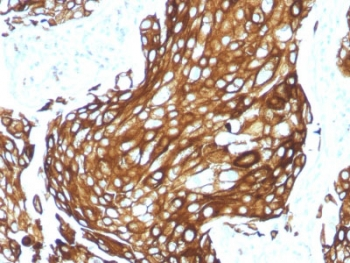 Acidic Cytokeratin Antibody