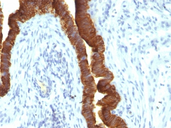 EpCAM Antibody / Cytoplasmic domain