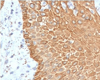 Multi Cytokeratin Antibody