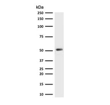 KRT7 Antibody / Cytokeratin 7