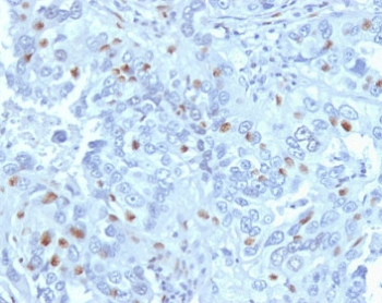 Cyclin A2 Antibody / CCNA2