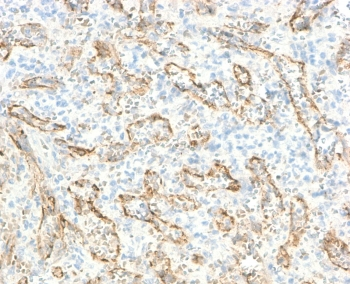 TNFSF15 Antibody / VEGI / TL1A