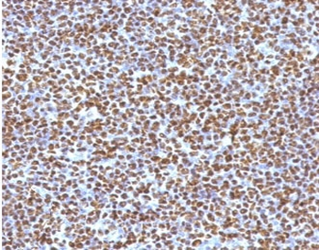 ALK Antibody / Anaplastic Lymphoma Kinase