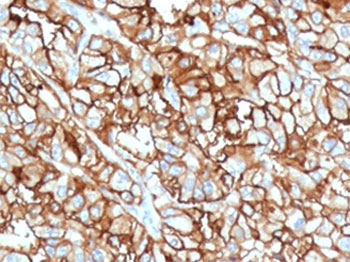 CD10 Antibody / Neprilysin