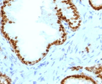 ATRX Antibody / RAD54