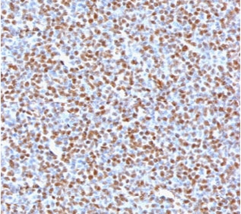 ALK Antibody / Anaplastic Lymphoma Kinase