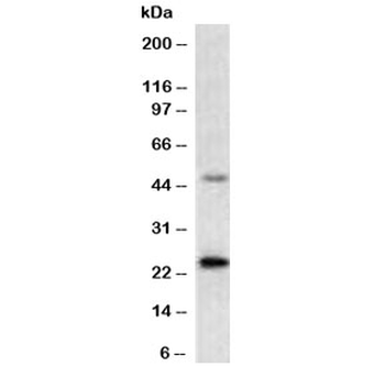 Mammaglobin A Antibody / SCGB2A2