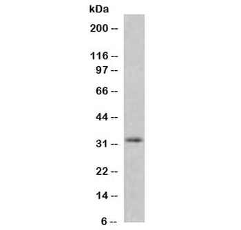 MTAP Antibody