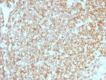 CD45 Antibody Cocktail (Leukocyte marker)
