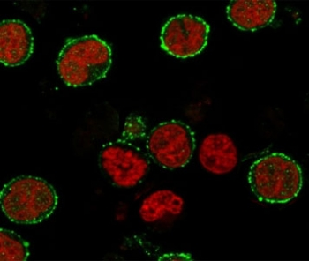 CD6 Antibody