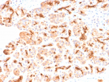 CFTR Antibody / Cystic Fibrosis Transmembrane Regulator