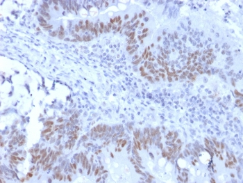 Retinoblastoma Antibody / Rb1