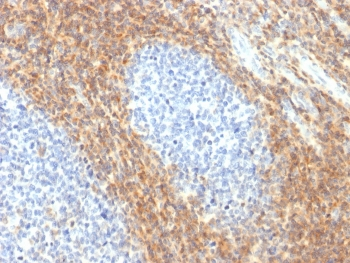 CD52 Antibody