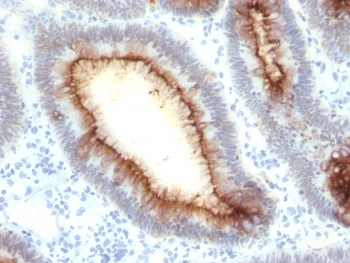 CEA Antibody / Carcinoembryonic Antigen