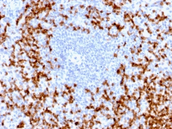 MMP9 Antibody / Matrix metalloproteinase-9