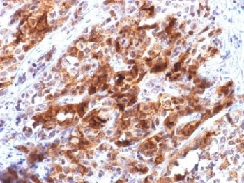 Glypican 3 Antibody / GPC3