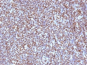 ALK Antibody / Anaplastic Lymphoma Kinase