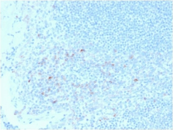 CD25 Antibody / IL2RA