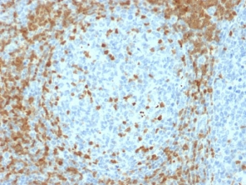 ZAP70 Antibody