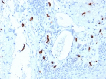 TPSAB1 Antibody / Mast Cell Tryptase