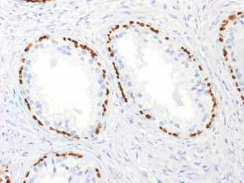 p63 Antibody / Tumor protein 63